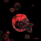 Organoide de càncer colorectal amb cèl·lules residuals responsables de la recaiguda marcades en roig.