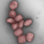 El virus de la viruela del mono podría transmitirse también por vía aérea