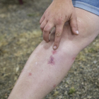 Un feriante sufrió varias picadas de mosca negra en la pierna.