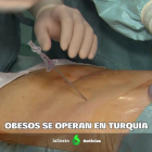 Muchos españoles van a Turquía para retoques y cirugía estética.