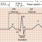 electrocardiograma: