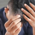 Imagen de una persona a la que se le cae el pelo.