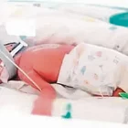 Les quadrigèmines idèntiques a l’UCI neonatal de l’hospital. - METRO NORTH HEALTH