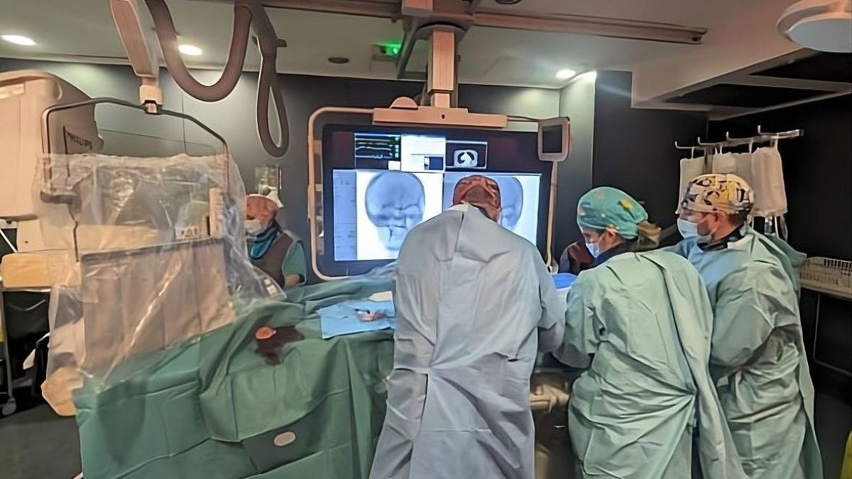 Profesionales llevando a cabo una trombectomía mecánica en el hospital Arnau. - JUNTS