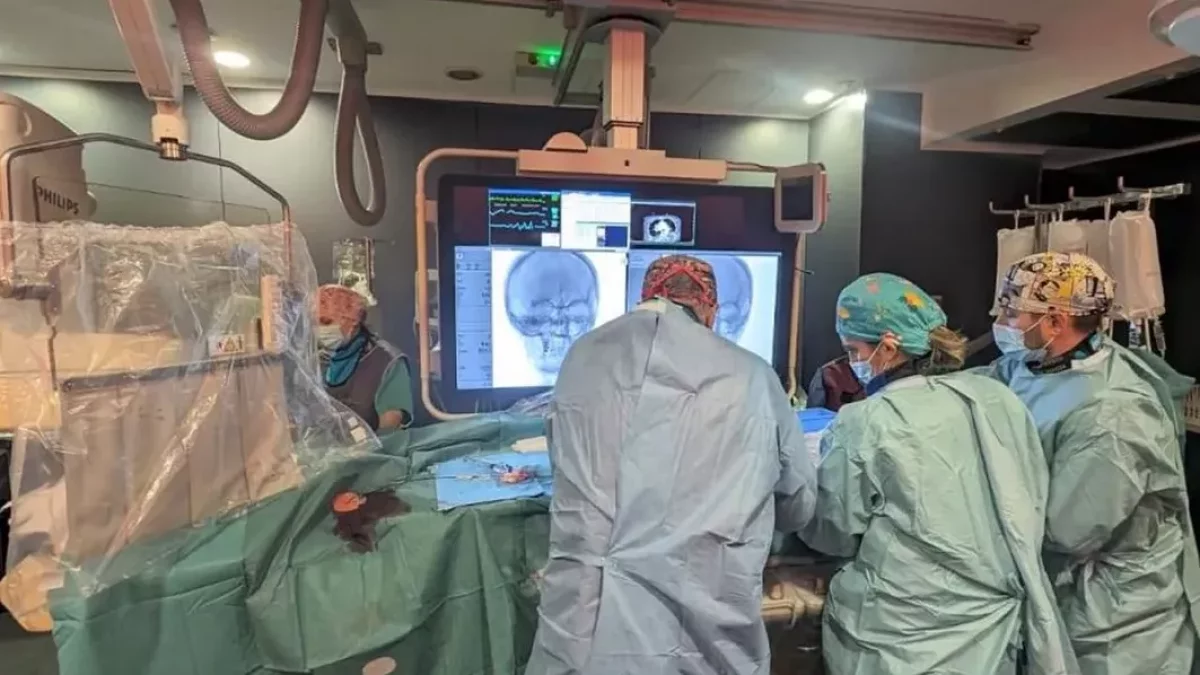 Profesionales llevando a cabo una trombectomía mecánica en el hospital Arnau de Vilanova. - ICS LLEIDA