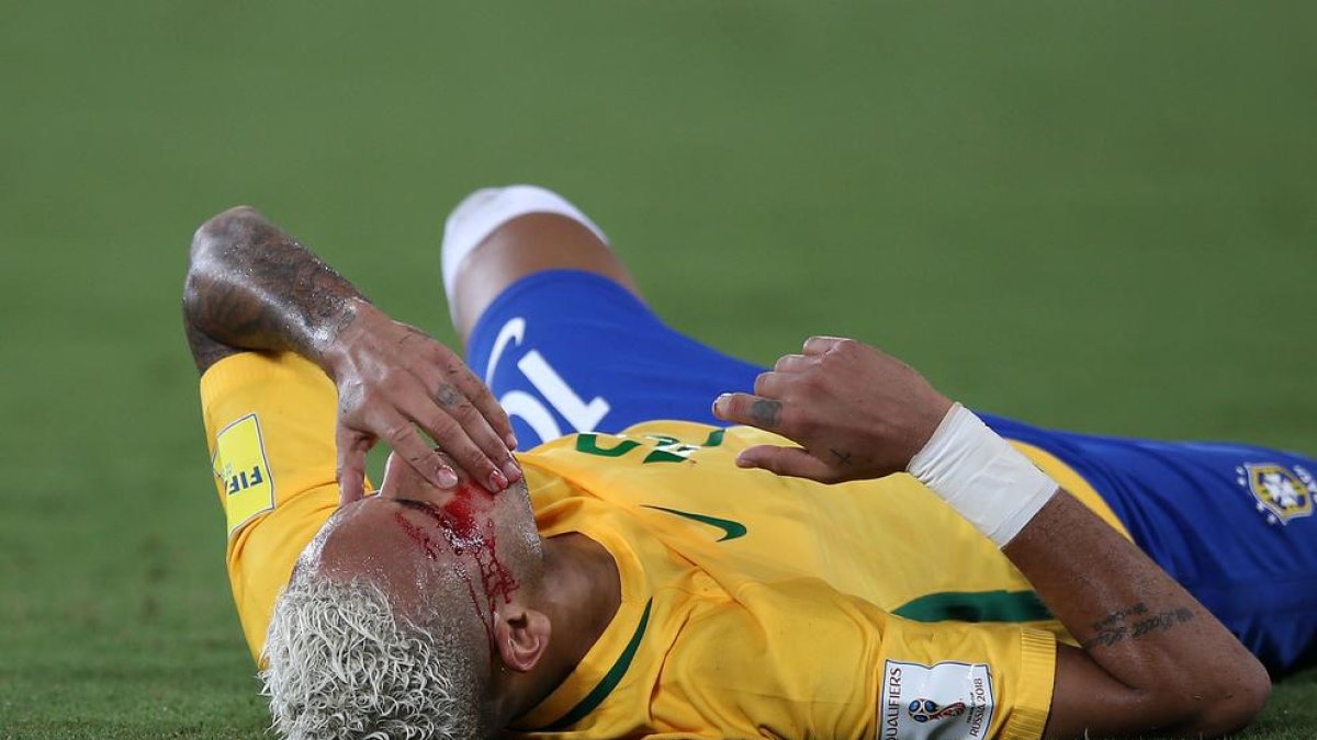 Neymar, ajagut a la gespa amb la cara ensagnada després del cop de colze que li va clavar un rival.