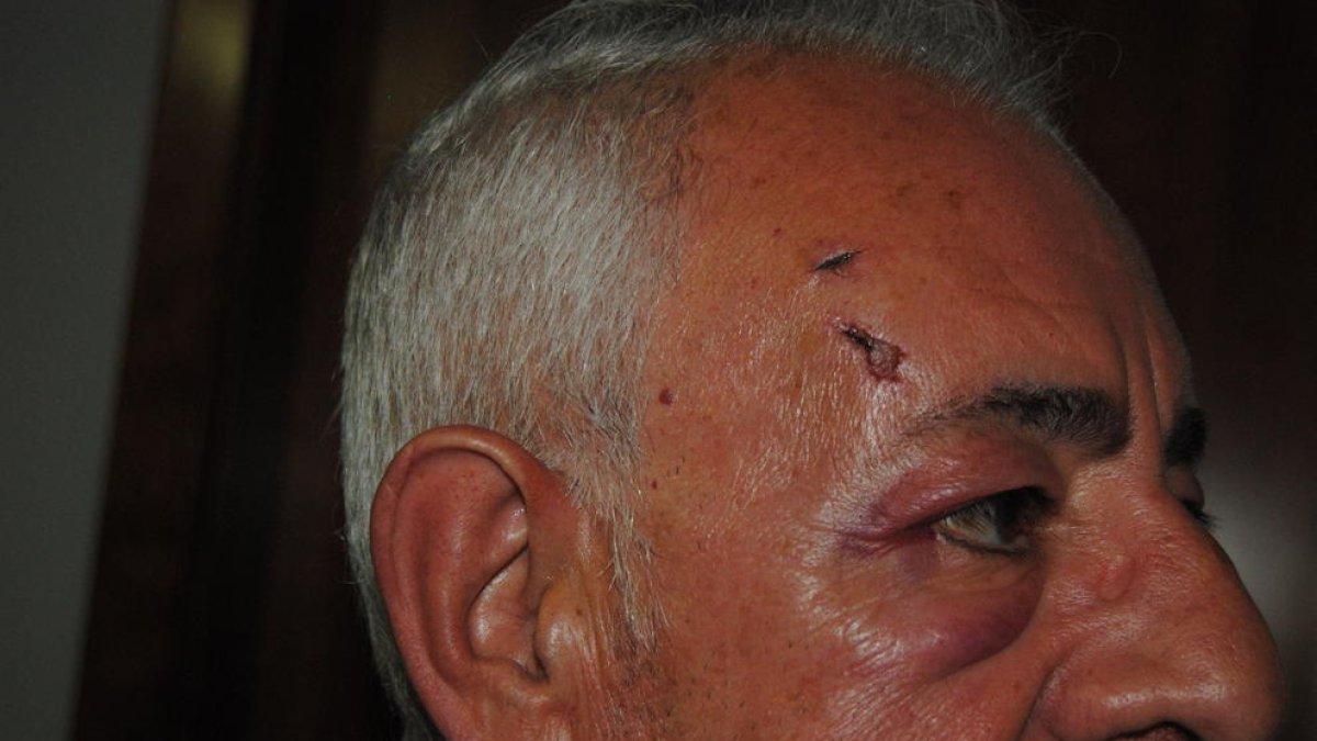 Las heridas que ha denunciado uno de los vecinos.