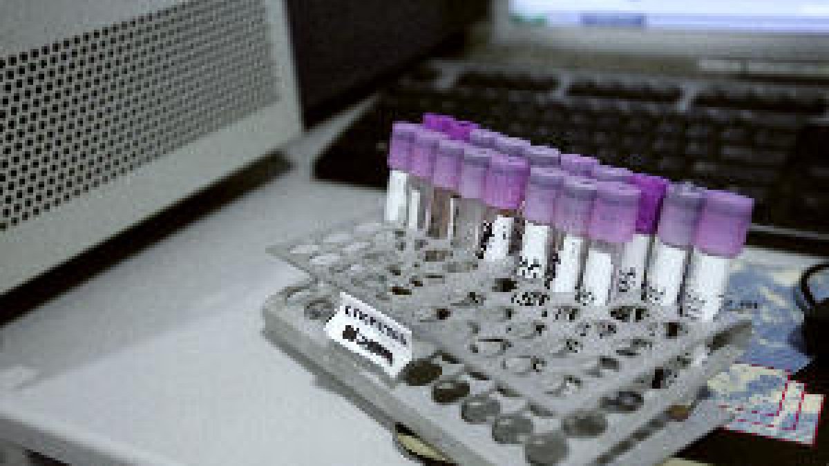 Un estudio del Hospital del Mar halla una pieza clave para tratar el cáncer de páncreas