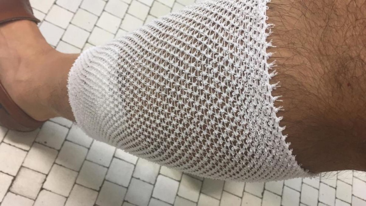 El ciclista va requerir atenció sanitària per la mossegada a la cama.