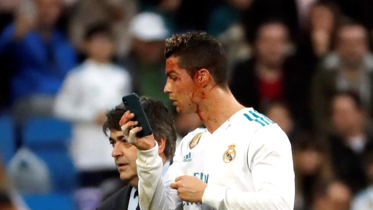 Cristiano se mira en un móvil el corte que se hizo durante el partido y que precisó de un par de puntos.