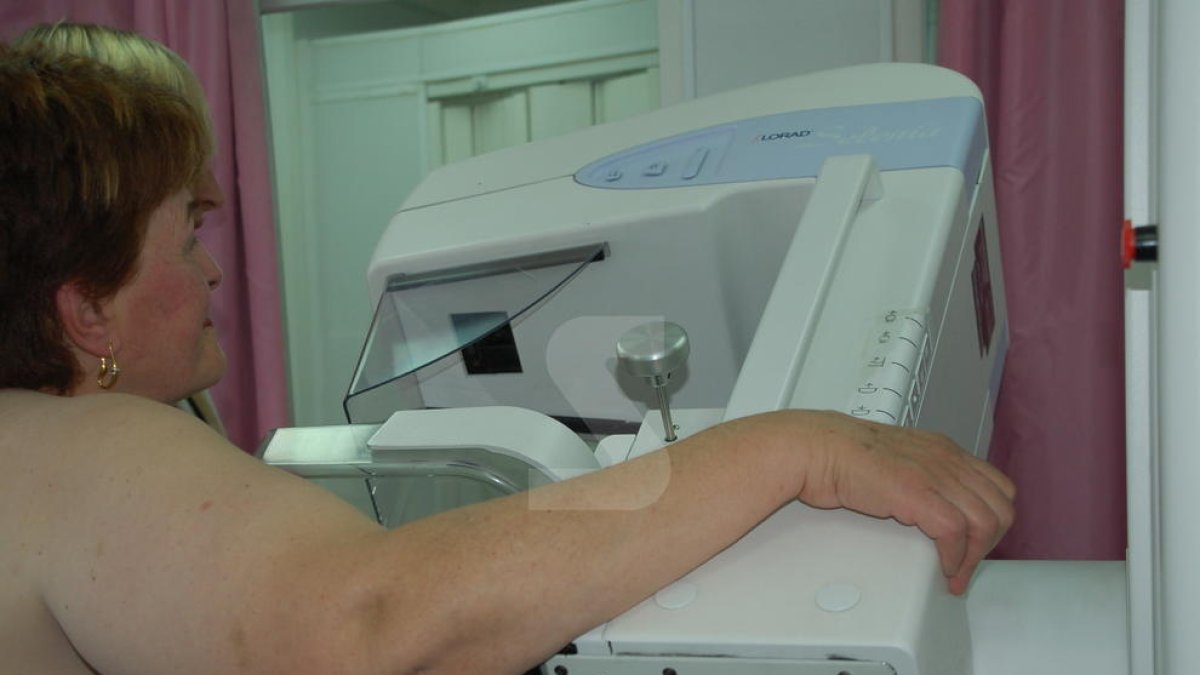 Detectats de manera precoç 51 càncers de mama a Lleida el 2018 amb el programa de cribratge