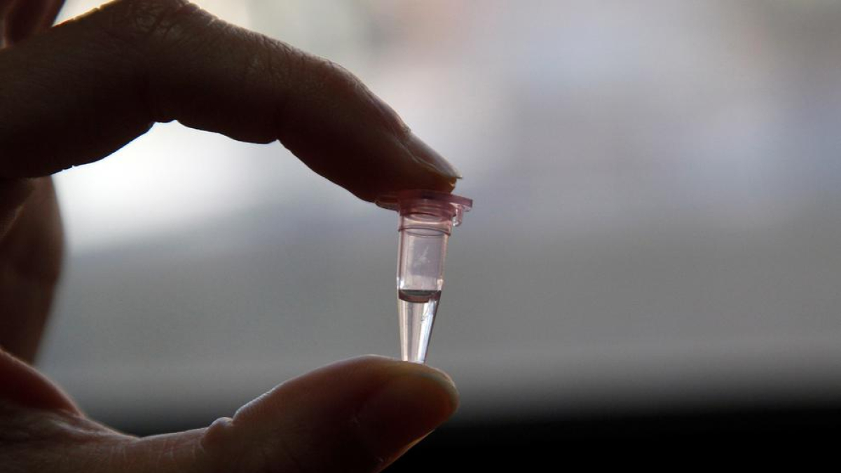 Muestras de espermas preparadas para un estudio.