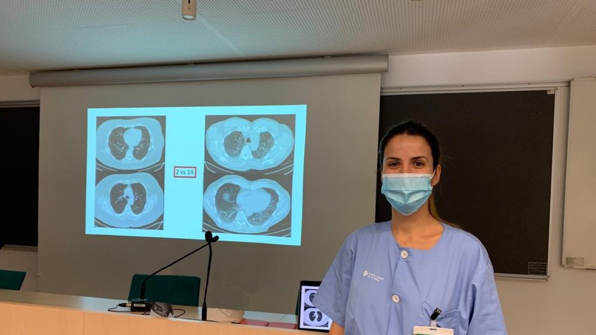 La doctora Jessica González Gutiérrez, facultativa especialista del servicio de Pneumologia del Hospital Universitario Arnau de Vilanova de Lleida.