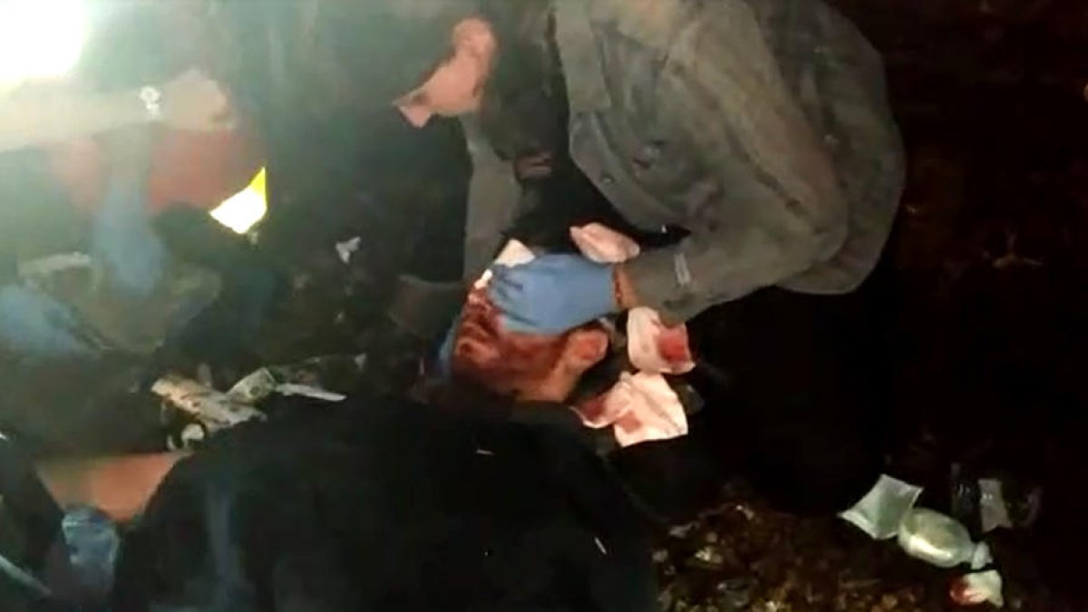 Un lleidatà perd la visió en un ull per una pilota de goma o foam a l'aeroport del Prat