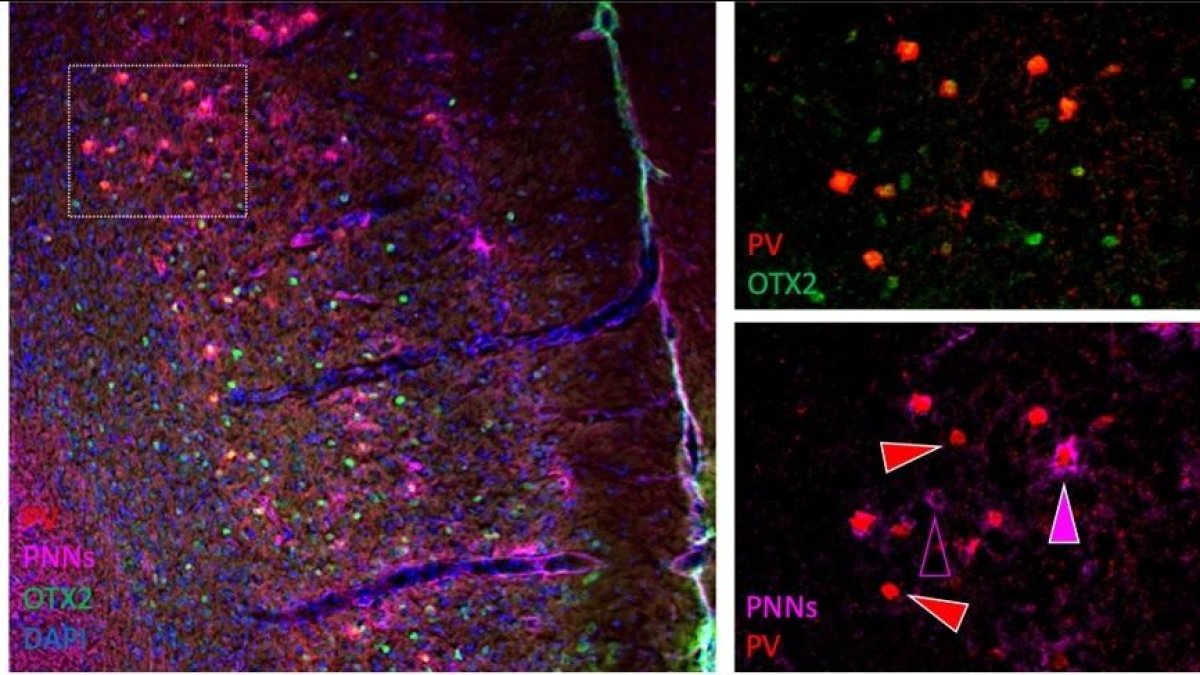 Desentranyen el mecanisme cerebral que regula l'ansietat