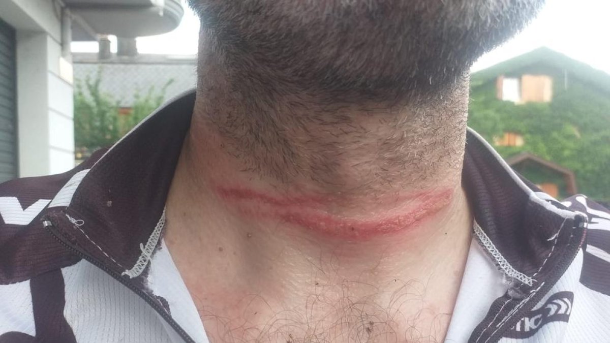 El ciclista va patir cremades al coll i hauria pogut ser molt pitjor.