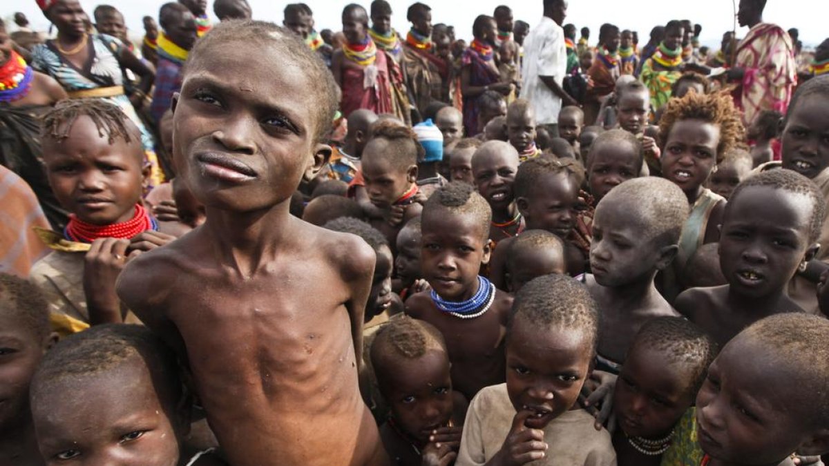 Niños de la etnia Turkana con graves problemas de malnutrición.