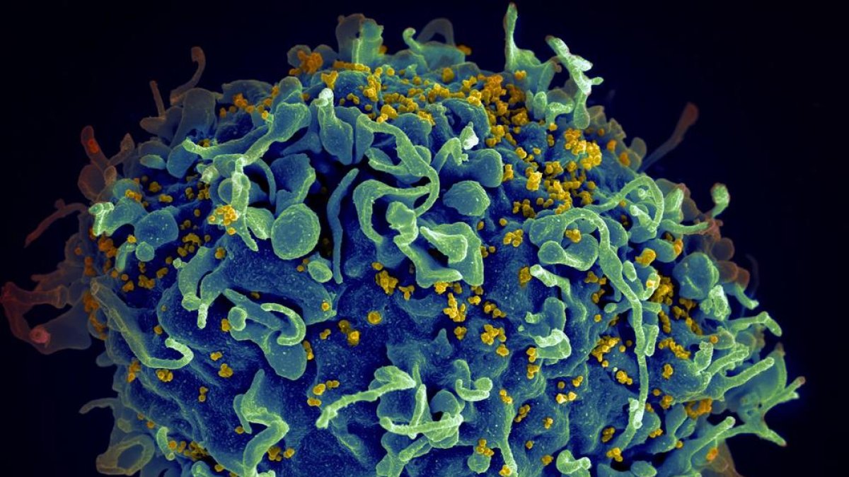El virus del Sida.