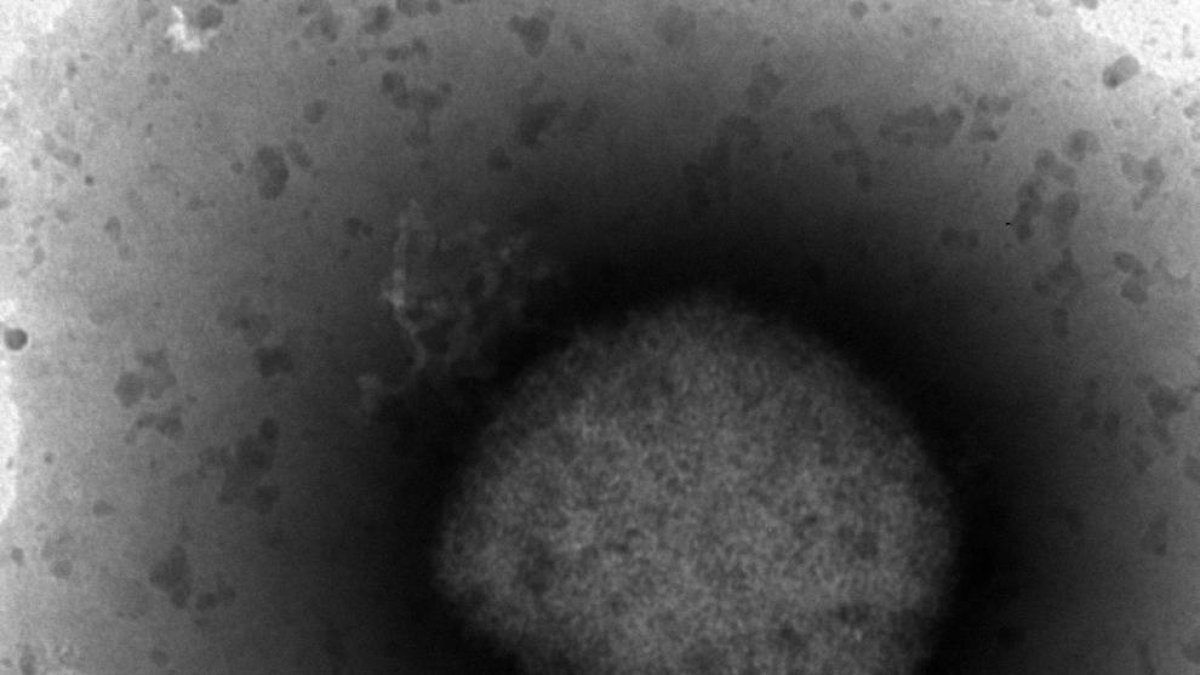El ISCIII ha obtingut la seqüència completa del genoma del virus de la verola del mico.