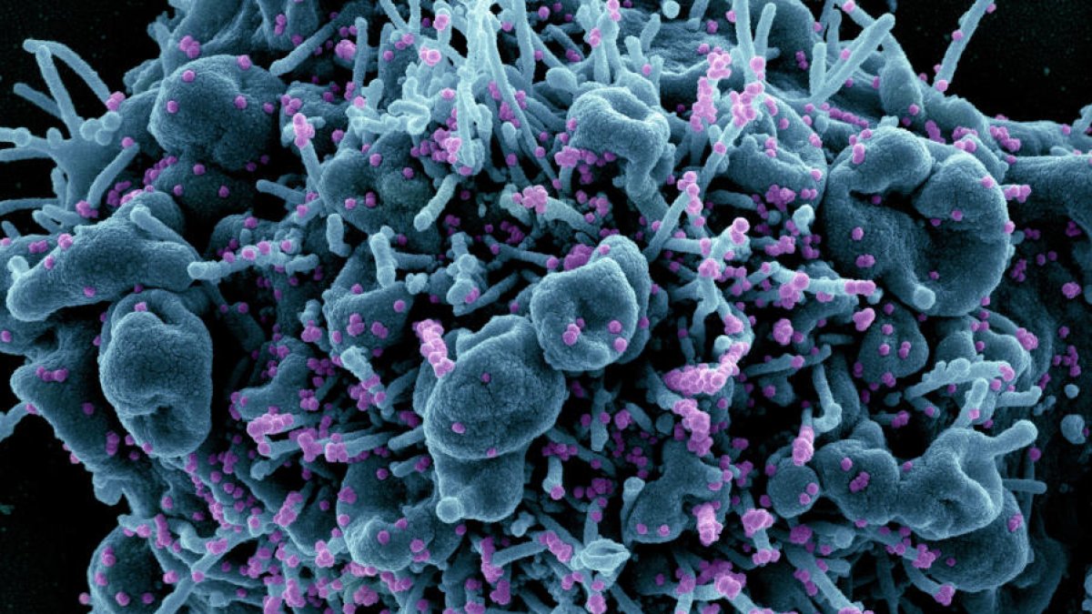 La Cianovirina-N podría frenar la infección de nuevas variantes del SARS-CoV-2