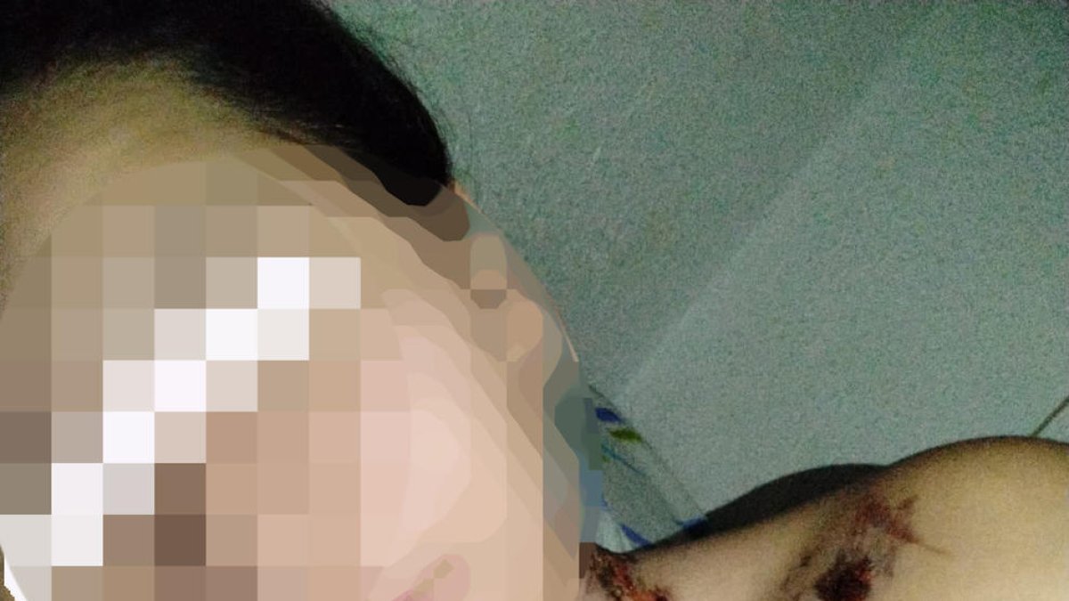 Liberan a una joven secuestrada y agredida por su pareja en Esplugues de Llobregat