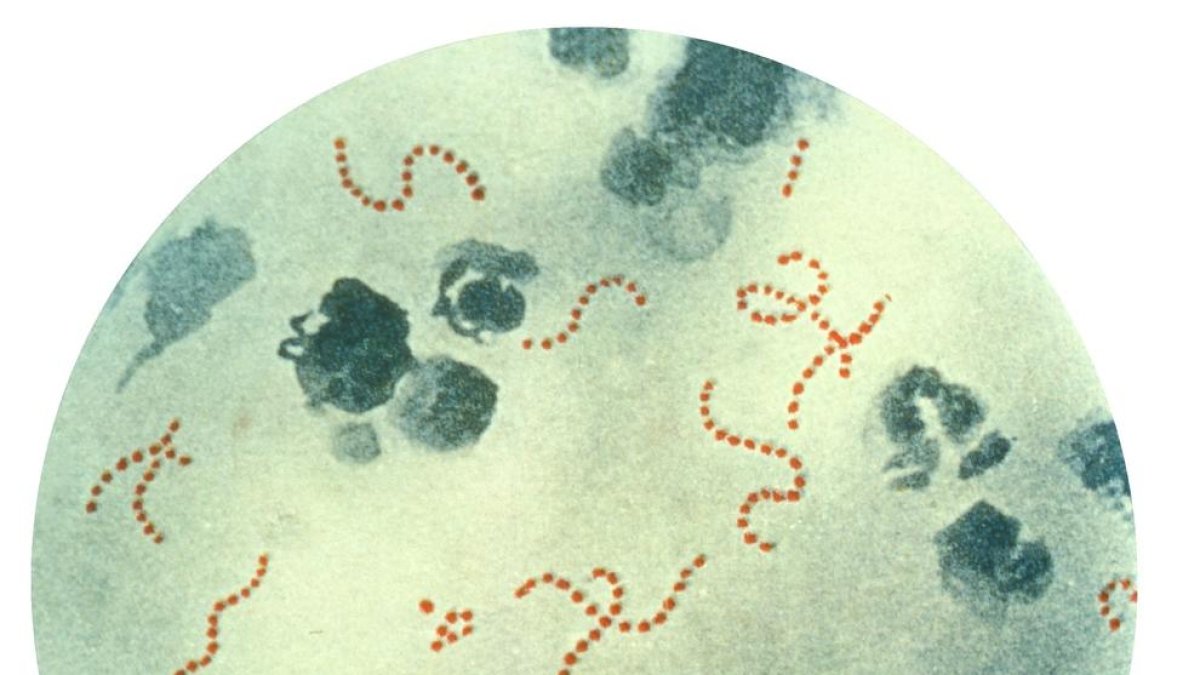 Bacteria 'streptococcus pyogenes'.