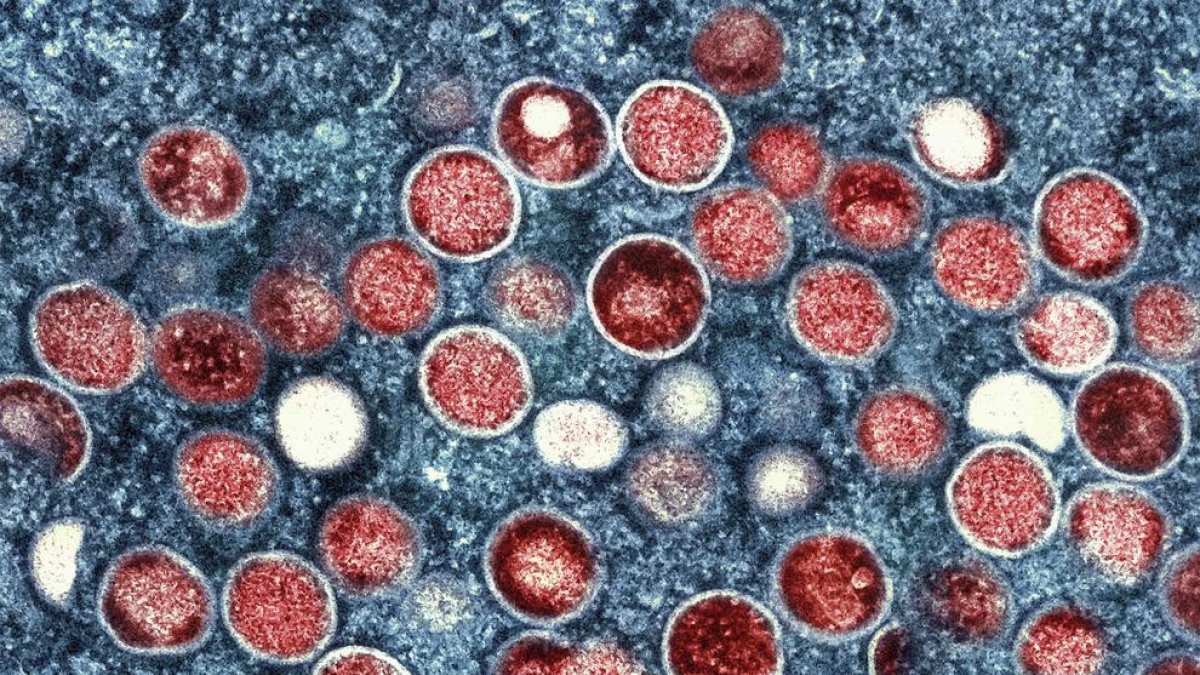 Una micrografía electrónica de transmisión de partículas del virus de la viruela símica.