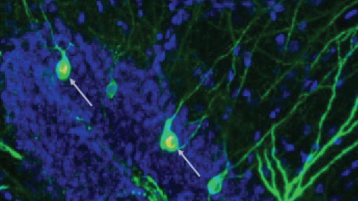 El nuevo estudio muestra que impulsar la neurogénesis aumenta la cantidad de neuronas recién formadas involucradas en el almacenamiento y la recuperación de recuerdos (flechas) en el hipocampo de ratones con alzhéimer.