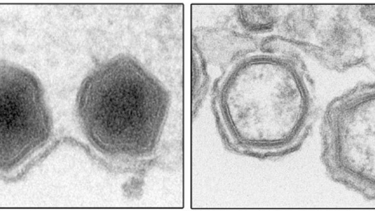 Identifiquen un mecanisme clau al virus de la pesta porcina africana