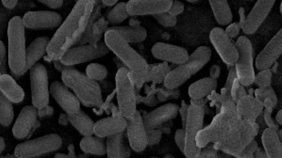 Arxiu- Imatge microscòpica de bacteris del gènere Listèria