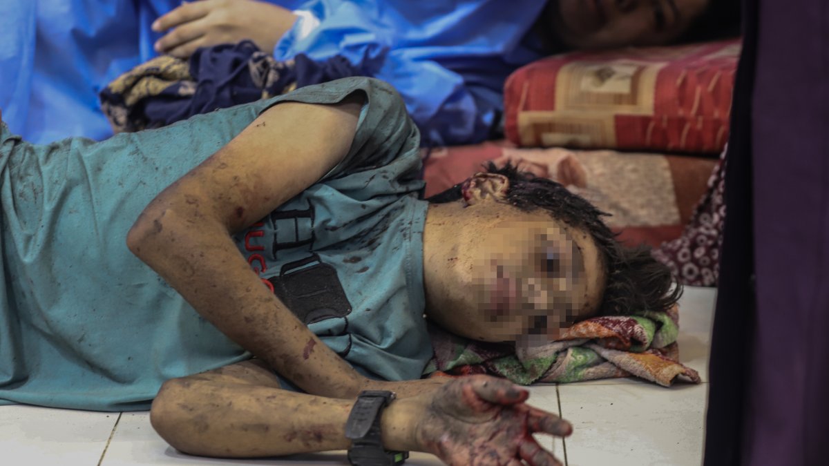 Un nen ferit en un hospital de Gaza.