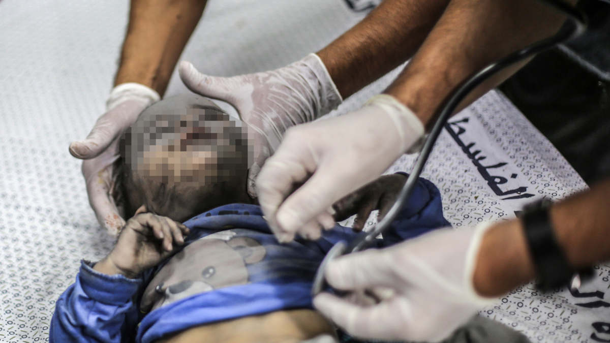 Un niño herido en un hospital de Gaza.