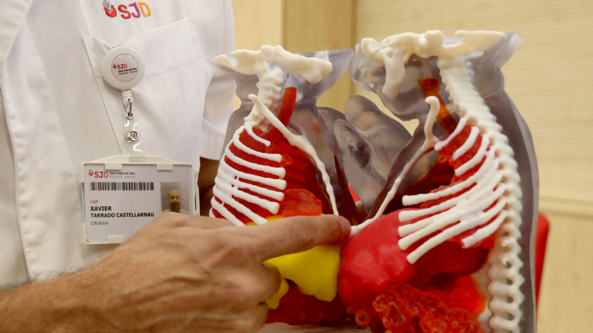 Simulador de l'abdomen compartit de les siameses mauritanes