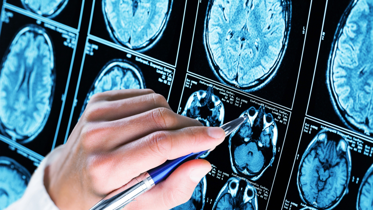 Archivo - Imagen de recurso sobre distintas zonas de un cerebro.