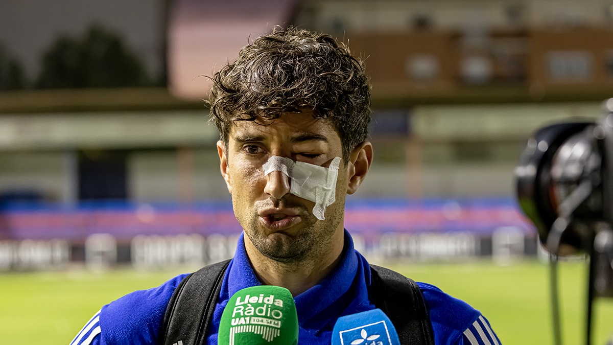 Campins va atendre la premsa amb un ull completament inflat.