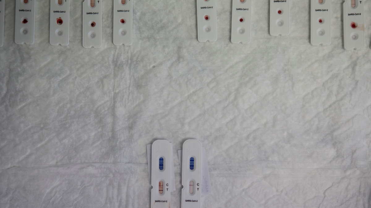 Fotografía de archivo de varios test rápidos utilizados para saber si una persona ha generado anticuerpos del Covid-19.