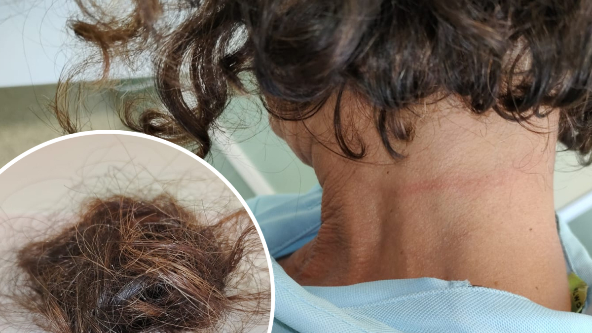 Lesions al coll de la funcionària lleidatana agredida.