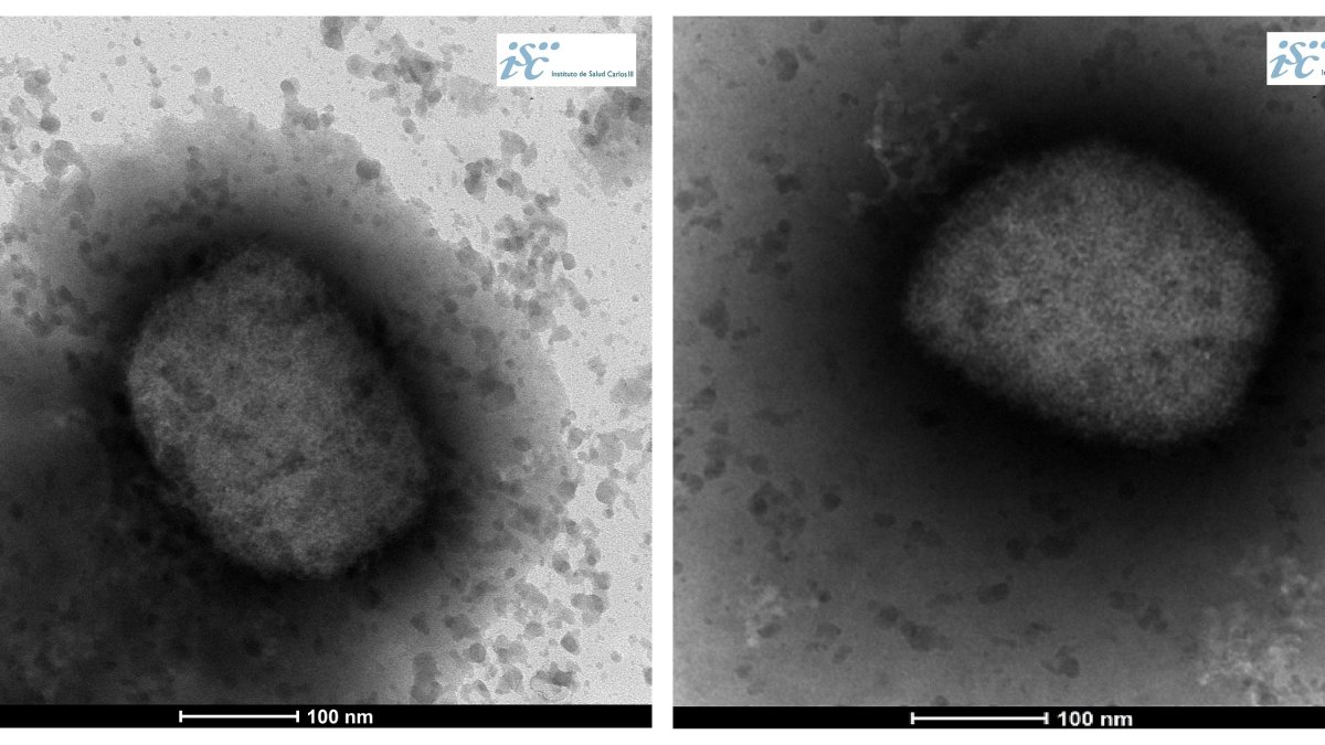 Viruela del mono

12/1/2024