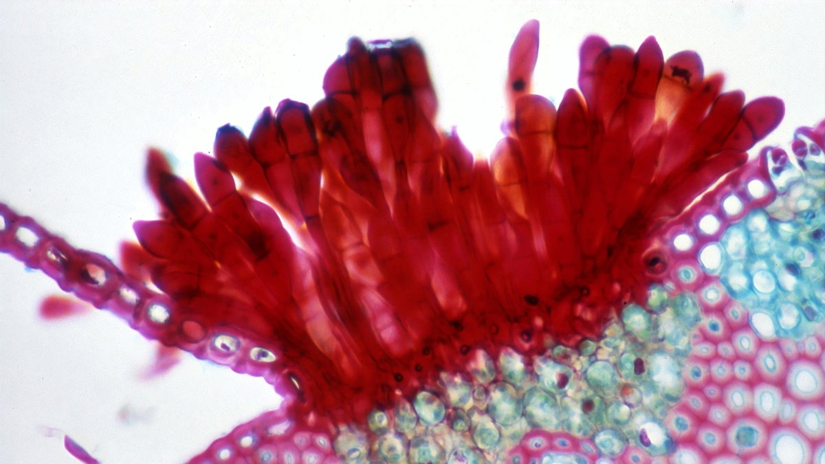 Imagen de un hongo visto a través del microscopio.