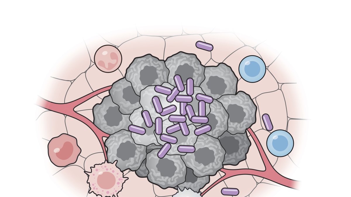 Cèl·lules bacterianes artificials (porpra) activen diverses parts del sistema immunitari per atacar les cèl·lules tumorals (gris).