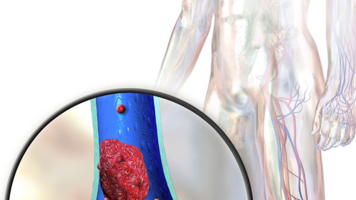 L’escala de Wells - VIQUIPÈDIA