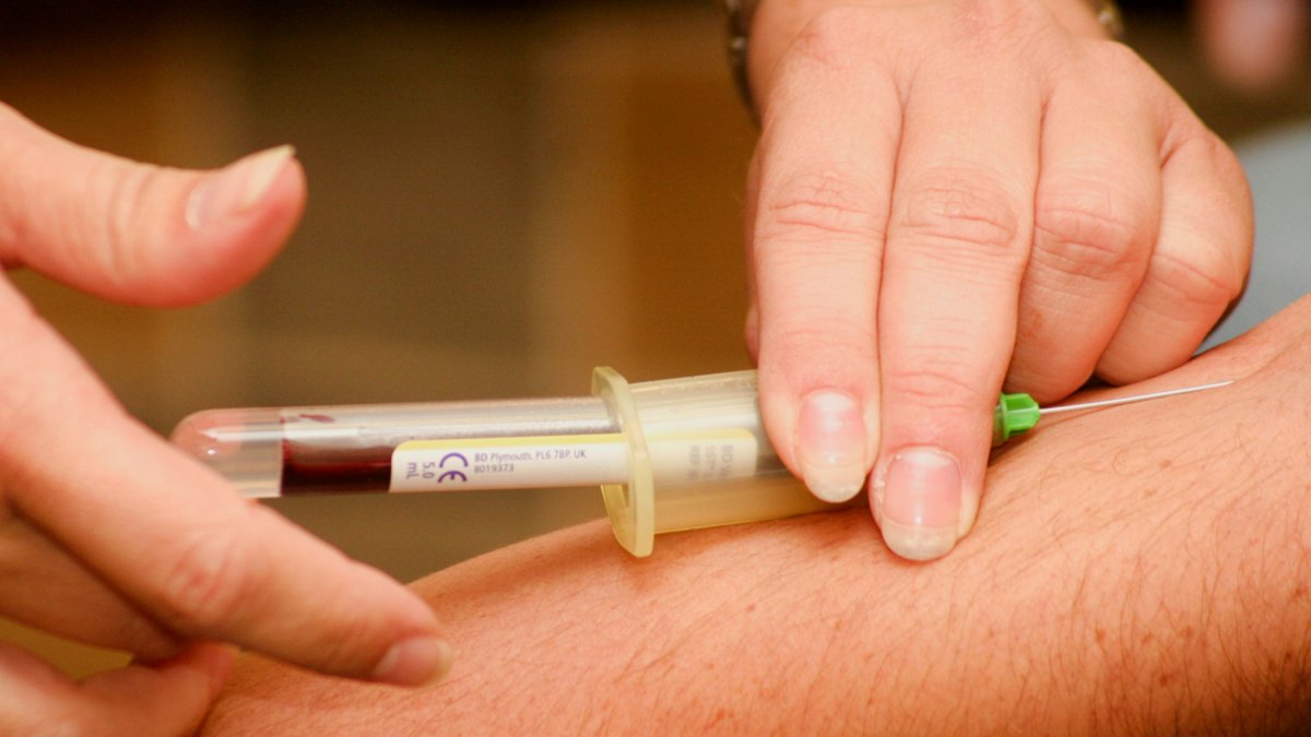 Una startup barcelonesa ha desarrollado un innovador test de sangre capaz de detectar con precisión cinco tipos de cáncer.