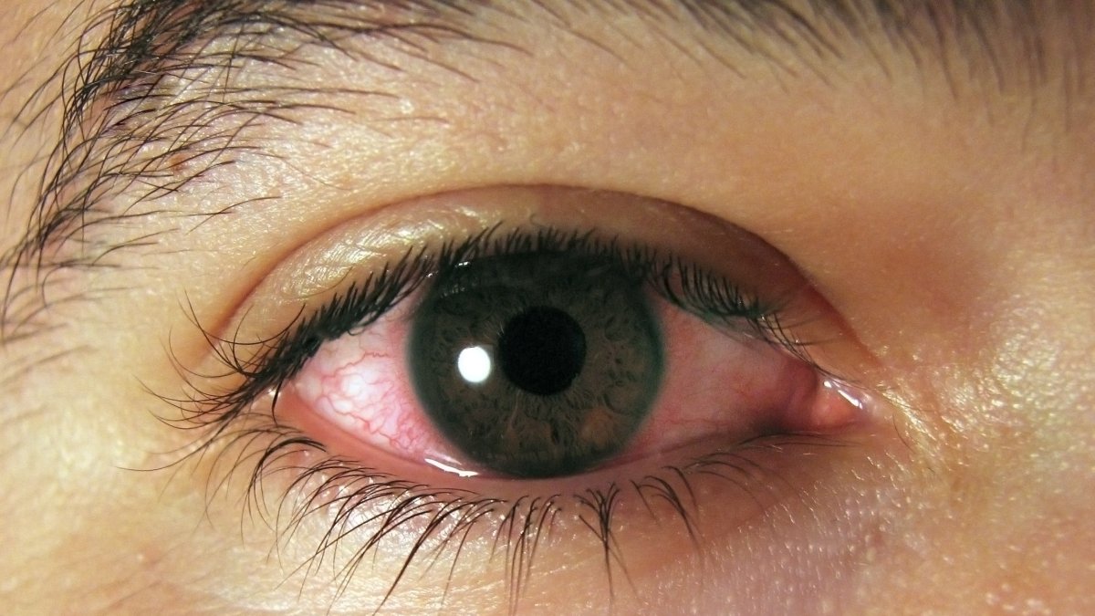 INNOVA OCULAR / via Europa Press