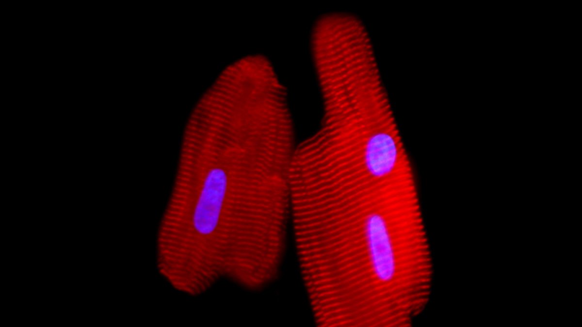 Imatges microscòpiques de cardiomiòcits (cèl·lules musculars del cor) de rata en cultiu.