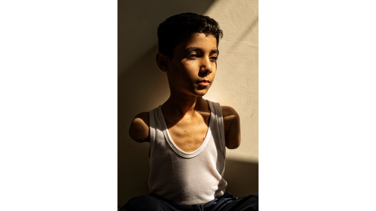 Mahmoud Ajjour, Aged Nine, de Samar Abu Elouf per 'The New York Times', la World Press Photo de l'Any