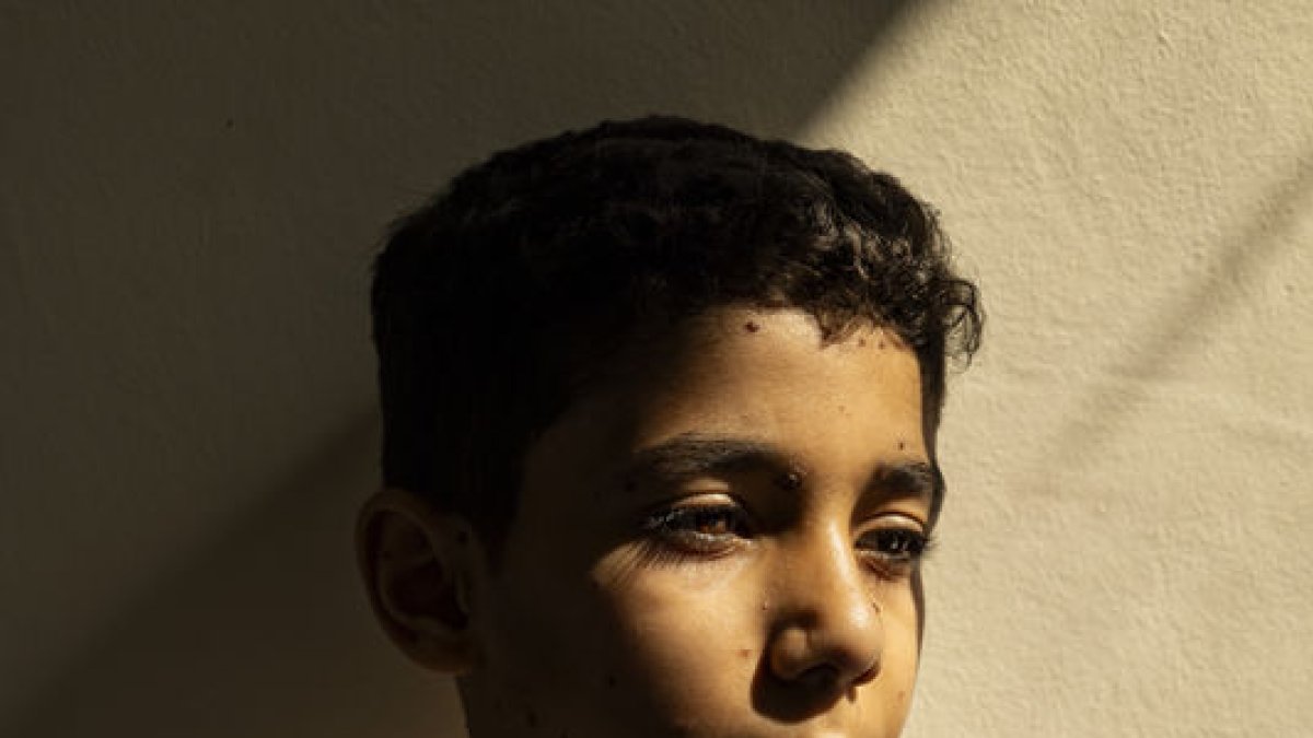 La foto premiada, que muestra a Mahmoud Ajjour. - SAMAR ABU ELOUF