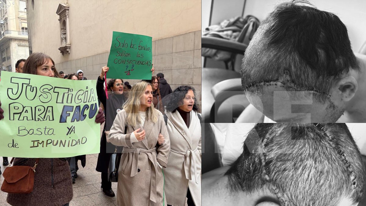 Facu, el hombre de 37 años agredido brutalmente en la zona de los Vins de Lleida, sale del coma