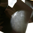 Una prova radiológica de mama.