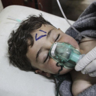Un niño recibe tratamiento médico tras un supuesto ataque químico contra la localidad de Jan Shijún