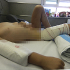 Imágenes de la niña tomadas ayer en el hospital, seis días después de ser brutalmente atacada por un perro en una calle de Alcarràs.